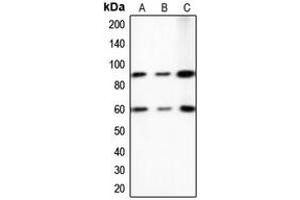 Western blot analysis of PE2 expression in A431 (A), HeLa (B), NIH3T3 (C) whole cell lysates.