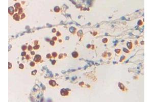 IHC-P analysis of Human Lung Tissue, with DAB staining. (PLA1A anticorps  (AA 309-452))