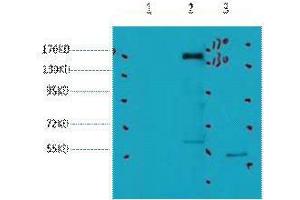 Western Blot (WB) analysis of 1) HeLa, 2) 293, 3) Jurkat, diluted at 1:2000. (ErbB2/Her2 anticorps)
