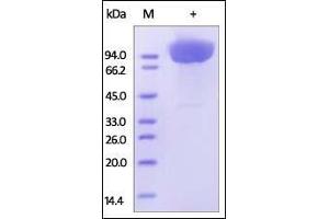 Human CD31, His Tag on SDS-PAGE under reducing (R) condition. (CD31 Protein (AA 28-601) (His tag))