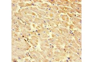 Immunohistochemistry of paraffin-embedded human heart tissue using ABIN7168509 at dilution of 1:100 (RYR2 anticorps  (AA 901-1192))