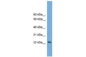 Western Blot showing RAB15 antibody used at a concentration of 1-2 ug/ml to detect its target protein.