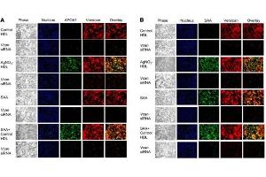 Immunofluorescence of Anti-Apolipoprotein AI.