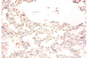 Immunohistochemistry of paraffin-embedded human lung tissue using ABIN7159501 at dilution of 1:50 (STEAP1 anticorps  (AA 3-69))