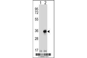 Western blot analysis of CBR3 using rabbit polyclonal CBR3 Antibody using 293 cell lysates (2 ug/lane) either nontransfected (Lane 1) or transiently transfected (Lane 2) with the CBR3 gene. (CBR3 anticorps  (C-Term))