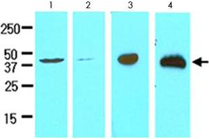 Cell lysates of HeLa (lane 1), MCF-7 (lane 2), LNCaP (lane 3) and mouse brain (lane 4) (30 ug) were resolved by SDS-PAGE and probed with TREM2 monoclonal antibody, clone 2B5  (1:500). (TREM2 anticorps  (AA 19-161))