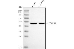 Western blot analysis of MLN64/STARD3 using anti-MLN64/STARD3 antibody (ABIN7601197).