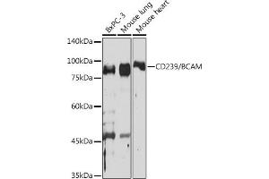 Western blot analysis of extracts of various cell lines, using CD239/BCAM Rabbit mAb (ABIN7265828) at 1:1000 dilution.