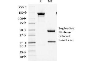 SDS-PAGE Analysis Purified MCM7 Mouse Monoclonal Antibody (MCM7/1466). (MCM7 anticorps  (AA 195-319))
