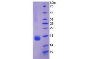 SDS-PAGE analysis of Rat Myoglobin Protein.