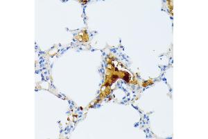 Immunohistochemistry of paraffin-embedded mouse lung using CTRB1 antibody (ABIN7266398) at dilution of 1:100 (40x lens).