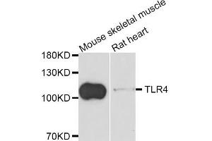 Western blot analysis of extracts of mouse skeletal muscle and rat heart cell lines, using TLR4 antibody.