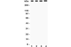 Western blot testing of IP3R antibody and Lane 1:  rat brain;  2: (r) liver;  3: human HeLa;  4: (h) HEPG2.
