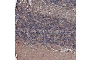 Immunohistochemical staining of human cerebellum with SUPT7L polyclonal antibody  shows distinct nucleolar positivity in purkinje cells at 1:200-1:500 dilution. (SUPT7L anticorps)