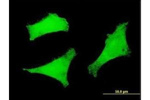 Immunofluorescence (IF) image for anti-Forkhead Box O3 (FOXO3) (AA 361-460) antibody (ABIN782401)