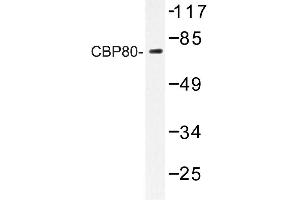Image no. 1 for anti-Nuclear Cap Binding Protein Subunit 1, 80kDa (NCBP1) antibody (ABIN272218) (NCBP1 anticorps)