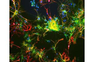 Neuron-glia cell mixture cultures stained with ABIN1842243 (green) and our Rabbit polyclonal antibody against GFAP: RPCA-GFAP (red). (Aldehyde Dehydrogenase H1L1 anticorps)