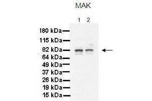 Lanes:   1. (MAK anticorps  (C-Term))