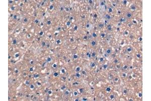 Detection of FGF15 in Rat Liver Tissue using Monoclonal Antibody to Fibroblast Growth Factor 15 (FGF15)
