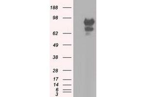 Western Blotting (WB) image for anti-Sorting Nexin 9 (SNX9) antibody (ABIN1501049) (SNX9 anticorps)