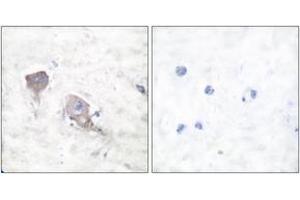 Immunohistochemistry analysis of paraffin-embedded human brain tissue, using SNAP25 Antibody.