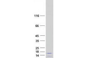 Validation with Western Blot