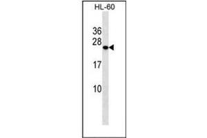 Western blot analysis of PCTP Antibody (Center) in HL-60 cell line lysates (35ug/lane). (PCTP anticorps  (Middle Region))