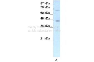 WB Suggested Anti-ESR2 Antibody Titration: 1. (ESR2 anticorps  (N-Term))