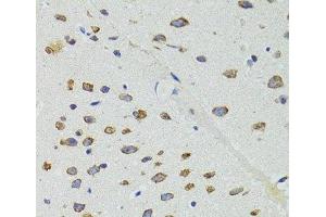 Immunohistochemistry of paraffin-embedded Mouse brain using DICER1 Polyclonal Antibody at dilution of 1:100 (40x lens).