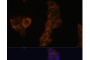 Immunofluorescence analysis of A-431 cells using RPL23A Polyclonal Antibody at dilution of 1:100. (RPL23A anticorps)