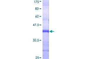 Image no. 1 for Cholinergic Receptor, Nicotinic, alpha 3 (Neuronal) (CHRNA3) (AA 32-141) protein (GST tag) (ABIN1349400)