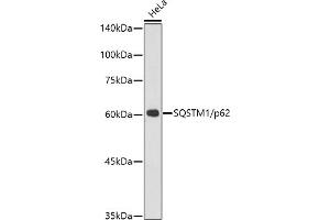Western blot analysis of extracts of HeLa cells, using SQSTM1/p62 antibody (ABIN7270205) at 1:1000 dilution.
