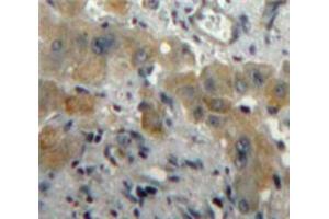 IHC-P analysis of Liver tissue, with DAB staining. (PLGF anticorps  (AA 43-162))