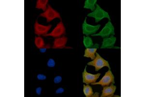 ABIN6257782 and ABIN6275437 staining Hela cells(45 min of heat-shock) by IF/ICC. (Rabenosyn 5 anticorps  (Internal Region))