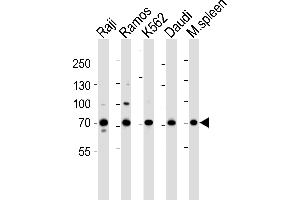 Western blot analysis of lysates from Raji, Ramos, K562, Daudi cell line and mouse spleen tissue lysate(from left to right), using BTK Antibody (Center) (ABIN6243554 and ABIN6577451).