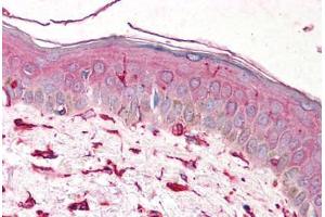 Human Skin (formalin-fixed, paraffin-embedded) stained with VIM antibody ABIN239818 at 5 ug/ml followed by biotinylated anti-mouse IgG secondary antibody ABIN481714, alkaline phosphatase-streptavidin and chromogen. (Vimentin anticorps)