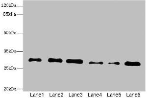 Western blot All lanes: STX7antibody at 2. (Syntaxin 7 anticorps  (AA 1-170))