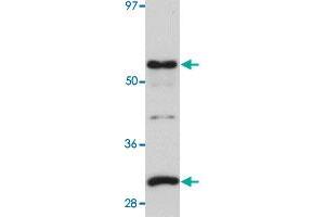 Western blot analysis of human lung tissue with SGK493 polyclonal antibody  at 1 ug/mL dilution.