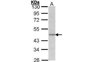 WB Image Sample (30 ug of whole cell lysate) A: A431 , 10% SDS PAGE antibody diluted at 1:1000 (Actin, gamma 1 anticorps  (N-Term))