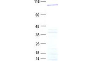 Validation with Western Blot