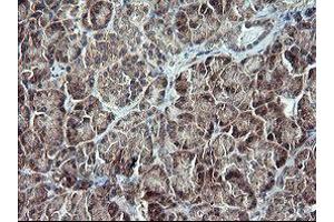 Image no. 3 for anti-Tumor Protein P73 (TP73) (AA 167-409) antibody (ABIN1491006)