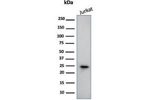 Western Blot Analysis of human Jurkat Cell lysate using CD3e Mouse Monoclonal Antibody (PC3/188A). (CD3 epsilon anticorps  (Cytoplasmic Domain))