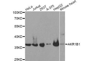 Western blot analysis of extracts of various cell lines, using AKR1B1 antibody. (AKR1B1 anticorps  (AA 1-316))