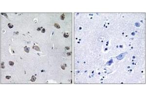 Immunohistochemistry analysis of paraffin-embedded human brain tissue, using MIPT3 Antibody. (TRAF3IP1 anticorps  (AA 221-270))