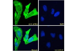 ABIN5893605-P1 Immunofluorescence analysis of paraformaldehyde fixed HeLa cells, permeabilised with 0. (AIF anticorps)