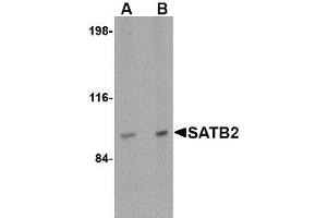 Image no. 1 for anti-SATB Homeobox 2 (SATB2) (N-Term) antibody (ABIN1494405)