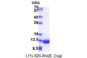 SDS-PAGE (SDS) image for LSM5 Homolog, U6 Small Nuclear RNA Associated (LSM5) (AA 1-91) protein (His tag) (ABIN5853303)