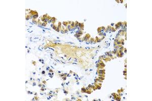 Immunohistochemistry of paraffin-embedded mouse lung using WNT9A antibody. (WNT9A anticorps)