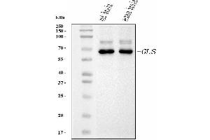 Western blot analysis of Glutaminase/GLS using anti-Glutaminase/GLS antibody (ABIN7601601). (Glutaminase anticorps  (AA 396-654))