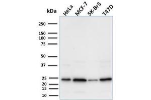 Western Blot Analysis using Mouse Mammaglobin-Monospecific Monoclonal Antibody (MGB1/2000).